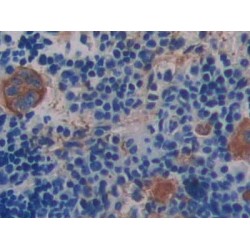 Integrin Beta III / CD61 (ITGB3) Antibody