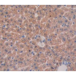 Integrin Beta III / CD61 (ITGB3) Antibody