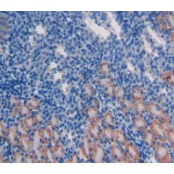 Ataxia Telangiectasia Mutated (ATM) Antibody