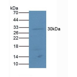 Activating Transcription Factor 4 (ATF4) Antibody