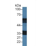 Western blot analysis of Mouse Stomach lysate, using Mouse IL18R1 Antibody (2 µg/ml) and HRP-conjugated Goat Anti-Rabbit antibody (<a href="https://www.abbexa.com/index.php?route=product/search&amp;search=abx400043" target="_blank">abx400043</a>, 0.2 µg/ml).