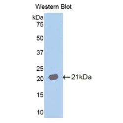 Interleukin 18 Receptor 1 (IL18R1) Antibody