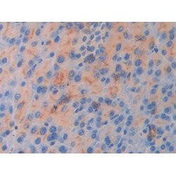 Interleukin 18 Receptor 1 (IL18R1) Antibody