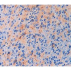 Interleukin 18 Receptor 1 (IL18R1) Antibody