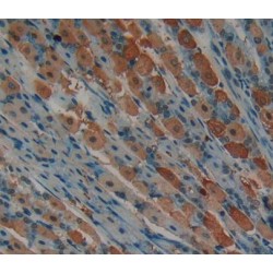 Cyclin Dependent Kinase 2 (CDK2) Antibody
