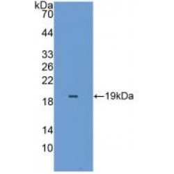 Peroxiredoxin 5 (PRDX5) Antibody