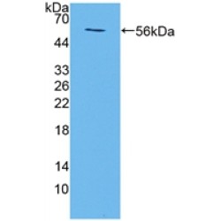 Transmembrane Protein 27 (TMEM27) Antibody