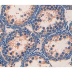 Angiotensin I Converting Enzyme (ACE) Antibody