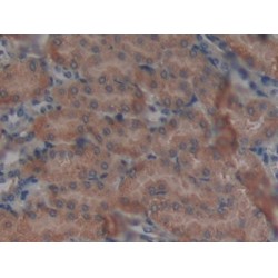 N-Acetylgalactosamine-6-Sulfatase (GAS) Antibody