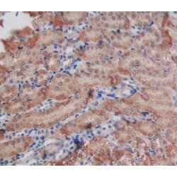 N-Acetylgalactosamine-6-Sulfatase (GAS) Antibody