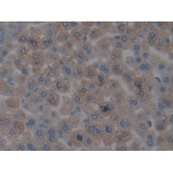 Centromere Protein H (CENPH) Antibody