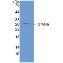 Glutamate Dehydrogenase 1 (GLUD1) Antibody