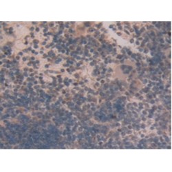 Glutamate Dehydrogenase 1 (GLUD1) Antibody