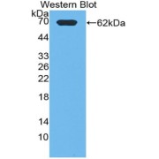 Western blot analysis of the recombinant protein.