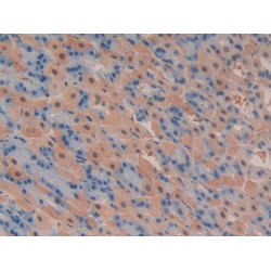 Phosphoinositide-3-Kinase Class-2-Alpha Polypeptide (PIK3C2a) Antibody