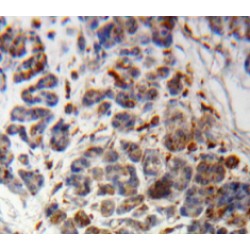 Phosphoinositide-3-Kinase Class-2-Alpha Polypeptide (PIK3C2a) Antibody