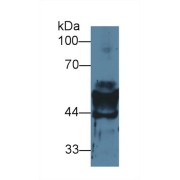 Western blot analysis of Mouse Stomach lysate, using Mouse KRT14 Antibody (2 µg/ml) and HRP-conjugated Goat Anti-Rabbit antibody (<a href="https://www.abbexa.com/index.php?route=product/search&amp;search=abx400043" target="_blank">abx400043</a>, 0.2 µg/ml).