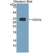 Western blot analysis of the recombinant protein.