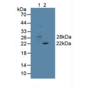 Western blot analysis of (1) Mouse Brain Tissue and (2) Mouse Lung Tissue.