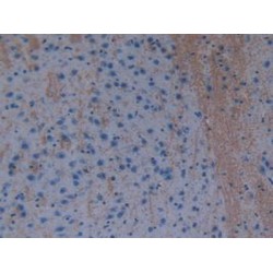 Glutathione S Transferase Theta 1 (GSTt1) Antibody