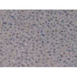 Glutathione S Transferase Theta 1 (GSTt1) Antibody