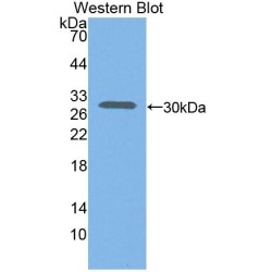 C-X-C Motif Chemokine 16 (CXCL16) Antibody