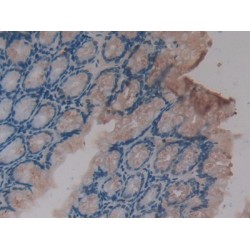 C-X-C Motif Chemokine 16 (CXCL16) Antibody