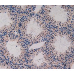 C-X-C Motif Chemokine 16 (CXCL16) Antibody