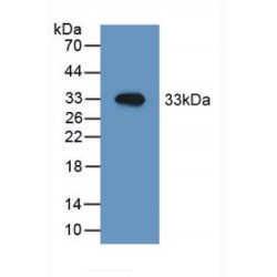 Heat Shock 60 kDa Protein 1, Chaperonin / HSP60 (HSPD1) Antibody