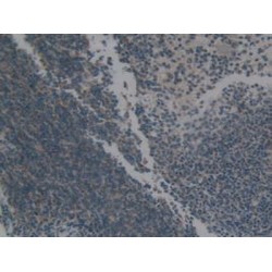 Heat Shock 60 kDa Protein 1, Chaperonin / HSP60 (HSPD1) Antibody