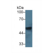Western blot analysis of Mouse Heart lysate, using Mouse vWA1 Antibody (5 µg/ml) and HRP-conjugated Goat Anti-Rabbit antibody (<a href="https://www.abbexa.com/index.php?route=product/search&amp;search=abx400043" target="_blank">abx400043</a>, 0.2 µg/ml).