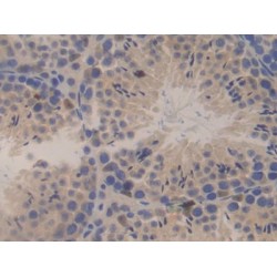 Sperm Specific Antigen 2 (SSFA2) Antibody