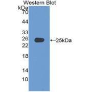 Western blot analysis of recombinant Mouse ADCY4 Protein.