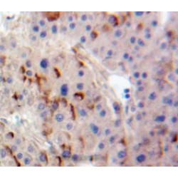 Adenylate Cyclase 4 (ADCY4) Antibody