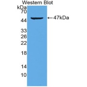 Western blot analysis of the recombinant protein.