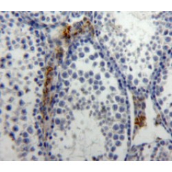 Interleukin 21 (IL21) Antibody