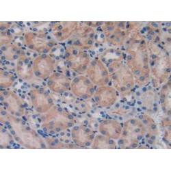 Protein Z Dependent Protease Inhibitor (ZPI) Antibody