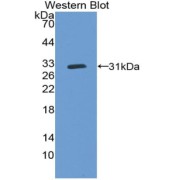 Western blot analysis of the recombinant protein.