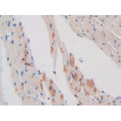 Sex Hormone Binding Globulin (SHBG) Antibody