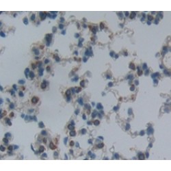 Integrin Alpha 2 (ITGa2) Antibody