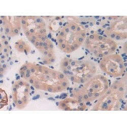 Breast Cancer Susceptibility Protein 2 (BRCA2) Antibody