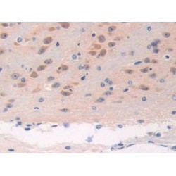 Breast Cancer Susceptibility Protein 2 (BRCA2) Antibody