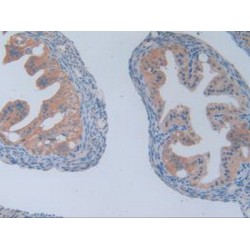 Phosphofructokinase, Platelet (PFKP) Antibody