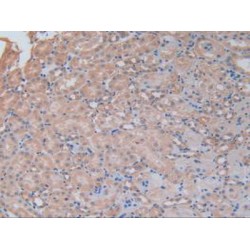 Phosphofructokinase, Platelet (PFKP) Antibody