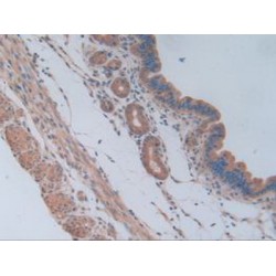 Phosphofructokinase, Platelet (PFKP) Antibody