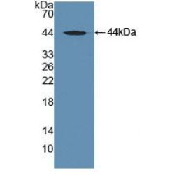 Microtubule-Associated Protein Tau (MAPT) Antibody