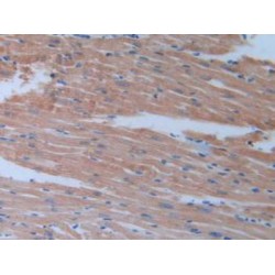 Brevican (BCAN) Antibody