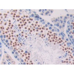 Pronociceptin (PNOC) Antibody