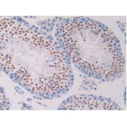 Pronociceptin (PNOC) Antibody