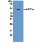 Western blot analysis of recombinant Mouse PLA2R1.